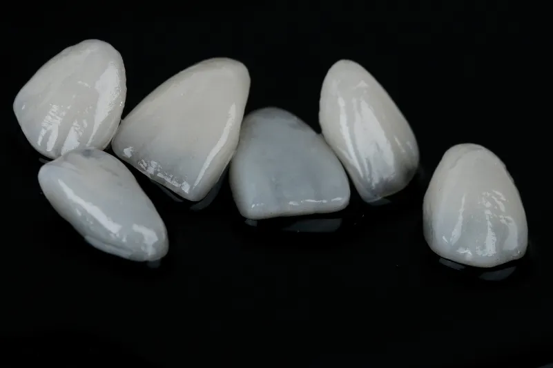 ラミネートベニア