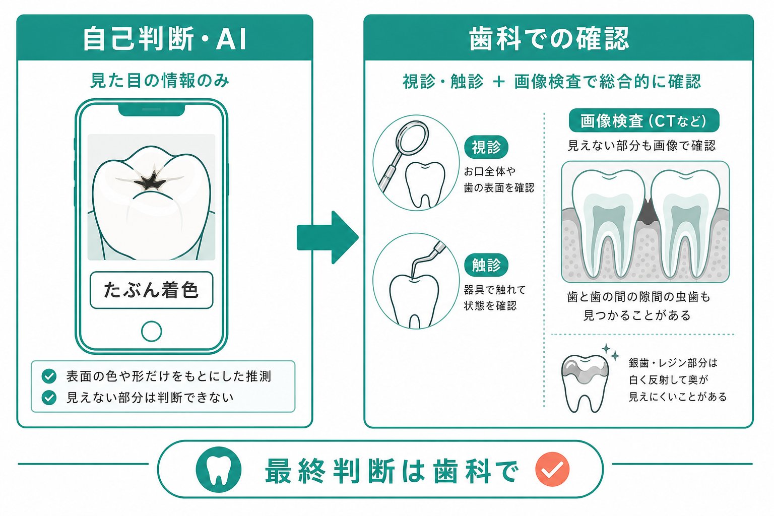 自己判断・AI診断と歯科検査の違い。見た目では分からない虫歯は画像検査で見つかることがある図